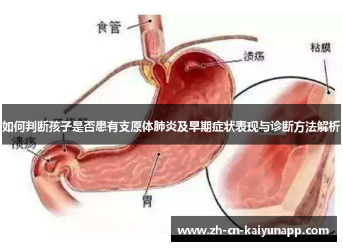 如何判断孩子是否患有支原体肺炎及早期症状表现与诊断方法解析